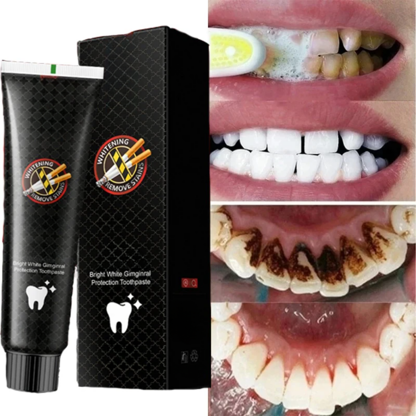 STAINLIFT™ Powerful Instant Whitening Pen